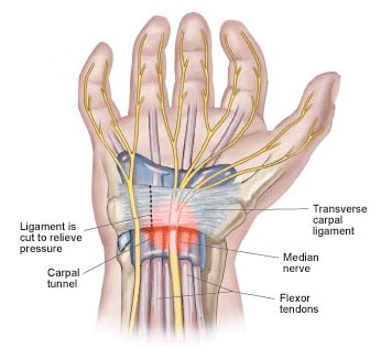 radiate ligament wrist